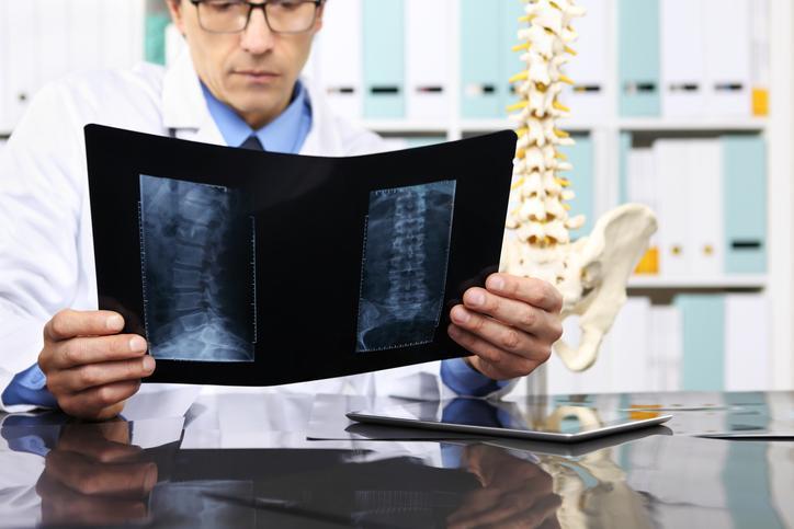When You Suffer a Slipped Disc Injury in an Auto Accident